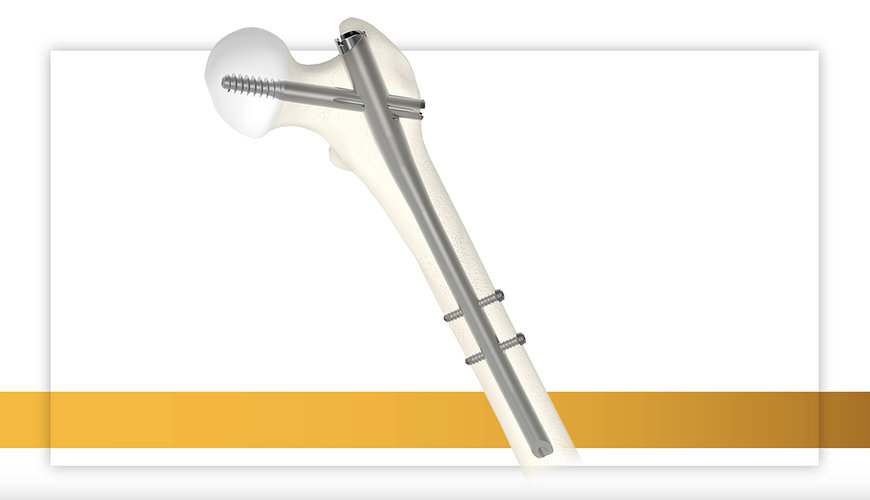 STRYKER EXPANDS GAMMA4 PORTFOLIO TO MEET THE NEEDS OF SURGEONS AND THEIR PATIENTS